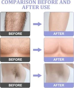Livingful Premium Crystal Hair Removal • Pijnloos Ontharing Epileerapparaat Voor Armen Benen Rug• Mannen En Vrouwen • Epilator Voor Langdurige Ontharing • Snelle En Gemakkelijke Exfoliërende Ontharin • Haarverwijderaar • Kristalpad • Zijdezachte Huid 12 Livingful Premium Crystal Hair Removal • Pijnloos Ontharing Epileerapparaat Voor Armen Benen Rug• Mannen En Vrouwen • Epilator Voor Langdurige Ontharing • Snelle En Gemakkelijke Exfoliërende Ontharin • Haarverwijderaar • Kristalpad • Zijdezachte Huid -Verzorgingsvoordeel Huis 1005x1200 1