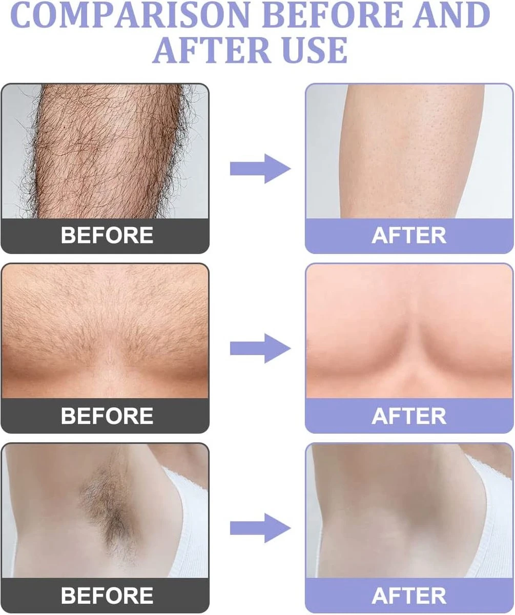 Livingful Premium Crystal Hair Removal • Pijnloos Ontharing Epileerapparaat Voor Armen Benen Rug• Mannen En Vrouwen • Epilator Voor Langdurige Ontharing • Snelle En Gemakkelijke Exfoliërende Ontharin • Haarverwijderaar • Kristalpad • Zijdezachte Huid 5 Livingful Premium Crystal Hair Removal • Pijnloos Ontharing Epileerapparaat Voor Armen Benen Rug• Mannen En Vrouwen • Epilator Voor Langdurige Ontharing • Snelle En Gemakkelijke Exfoliërende Ontharin • Haarverwijderaar • Kristalpad • Zijdezachte Huid - Afbeelding 5