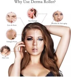 Dermaroller 1.5 Mm Met Cleaning Spray - 540 Naalden - Steriel Verpakt - Hoge Kwaliteit Chirurgisch Staal - Bewezen Effectief Tegen Rimpels, Acne Littekens, En Cellulitis & Stimulatie Van Haargroei Op De Hoofdhuid, Baardgroei 9 Dermaroller 1.5 Mm Met Cleaning Spray - 540 Naalden - Steriel Verpakt - Hoge Kwaliteit Chirurgisch Staal - Bewezen Effectief Tegen Rimpels, Acne Littekens, En Cellulitis & Stimulatie Van Haargroei Op De Hoofdhuid, Baardgroei -Verzorgingsvoordeel Huis 1111x1200 5