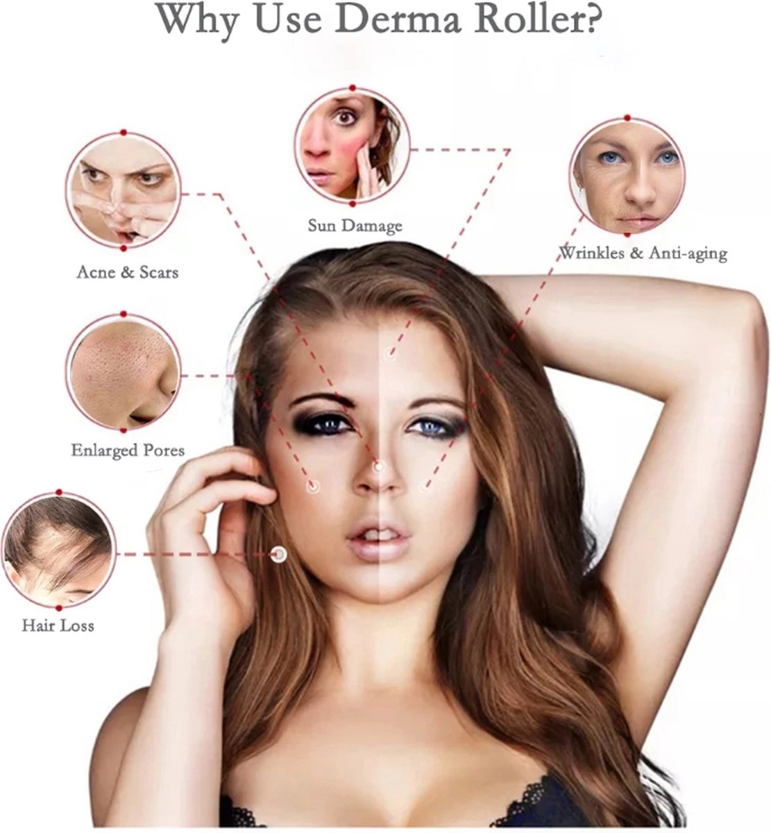 Dermaroller 1.5 Mm Met Cleaning Spray - 540 Naalden - Steriel Verpakt - Hoge Kwaliteit Chirurgisch Staal - Bewezen Effectief Tegen Rimpels, Acne Littekens, En Cellulitis & Stimulatie Van Haargroei Op De Hoofdhuid, Baardgroei 3 Dermaroller 1.5 Mm Met Cleaning Spray - 540 Naalden - Steriel Verpakt - Hoge Kwaliteit Chirurgisch Staal - Bewezen Effectief Tegen Rimpels, Acne Littekens, En Cellulitis & Stimulatie Van Haargroei Op De Hoofdhuid, Baardgroei - Afbeelding 3