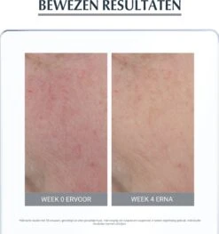 Eucerin Anti-redness Corrigerende Dagcrème SPF 25 - Dagcrème - 50 Ml -Verzorgingsvoordeel Huis 1125x1200 1