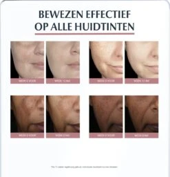 Eucerin Anti-Pigment Serum Duo - Serum - 30 Ml - Voor Alle Huidtypen -Verzorgingsvoordeel Huis 1157x1200 14