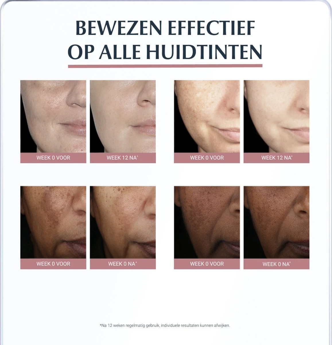 Eucerin Anti-Pigment Nachtcrème - 50 Ml 3 Eucerin Anti-Pigment Nachtcrème - 50 Ml - Afbeelding 3