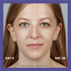 Olay Retinol24 - Nachtcrème - Met Retinol En Vitamine B3 - 50ml 9 Olay Retinol24 - Nachtcrème - Met Retinol En Vitamine B3 - 50ml -Verzorgingsvoordeel Huis 1198x1200 48