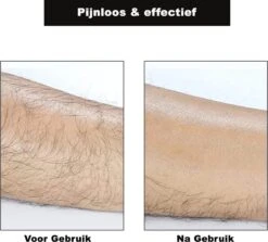 Crystal Hair Removal - Crystal Hair Eraser - Bleame - Kristalpad - Ontharing - Pijnloos - TikTok - Crystal Hair Remover - Haarverwijderaar -Verzorgingsvoordeel Huis 1200x1082 3