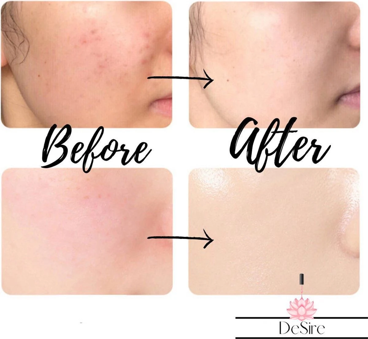 Derma Roller - 540 Needle - 0.5 MM Naald - Steriel Verpakt - Skin Roller - Huid Verzorging - Huidverzorging - Dermaroller - Baardgroei Stimuleren - HaarGroei Stimulatie - Haar En Huid - Strakke Huid - Acné - Puisten - Striae - Littekens 7 Derma Roller - 540 Needle - 0.5 MM Naald - Steriel Verpakt - Skin Roller - Huid Verzorging - Huidverzorging - Dermaroller - Baardgroei Stimuleren - HaarGroei Stimulatie - Haar En Huid - Strakke Huid - Acné - Puisten - Striae - Littekens - Afbeelding 7