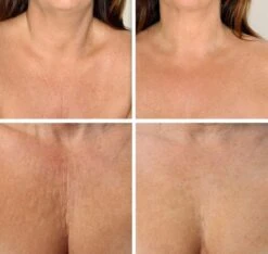 Simia™ Anti Rimpel Beauty Pads - Decolleté Large T Shape Set (2 Stuks) - Herbruikbaar Anti Aging Siliconen Pad Tegen Lijntjes En Slaaprimpels -Verzorgingsvoordeel Huis 1200x1139 1