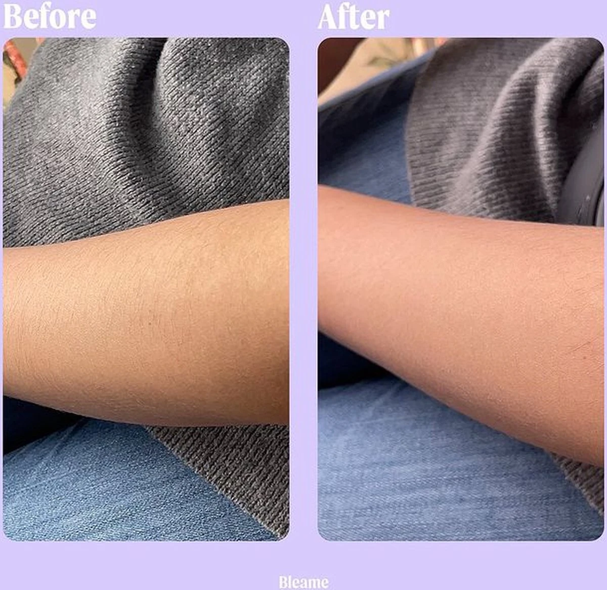 Livingful Premium Crystal Hair Removal • Pijnloos Ontharing Epileerapparaat Voor Armen Benen Rug• Mannen En Vrouwen • Epilator Voor Langdurige Ontharing • Snelle En Gemakkelijke Exfoliërende Ontharin • Haarverwijderaar • Kristalpad • Zijdezachte Huid 8 Livingful Premium Crystal Hair Removal • Pijnloos Ontharing Epileerapparaat Voor Armen Benen Rug• Mannen En Vrouwen • Epilator Voor Langdurige Ontharing • Snelle En Gemakkelijke Exfoliërende Ontharin • Haarverwijderaar • Kristalpad • Zijdezachte Huid - Afbeelding 8