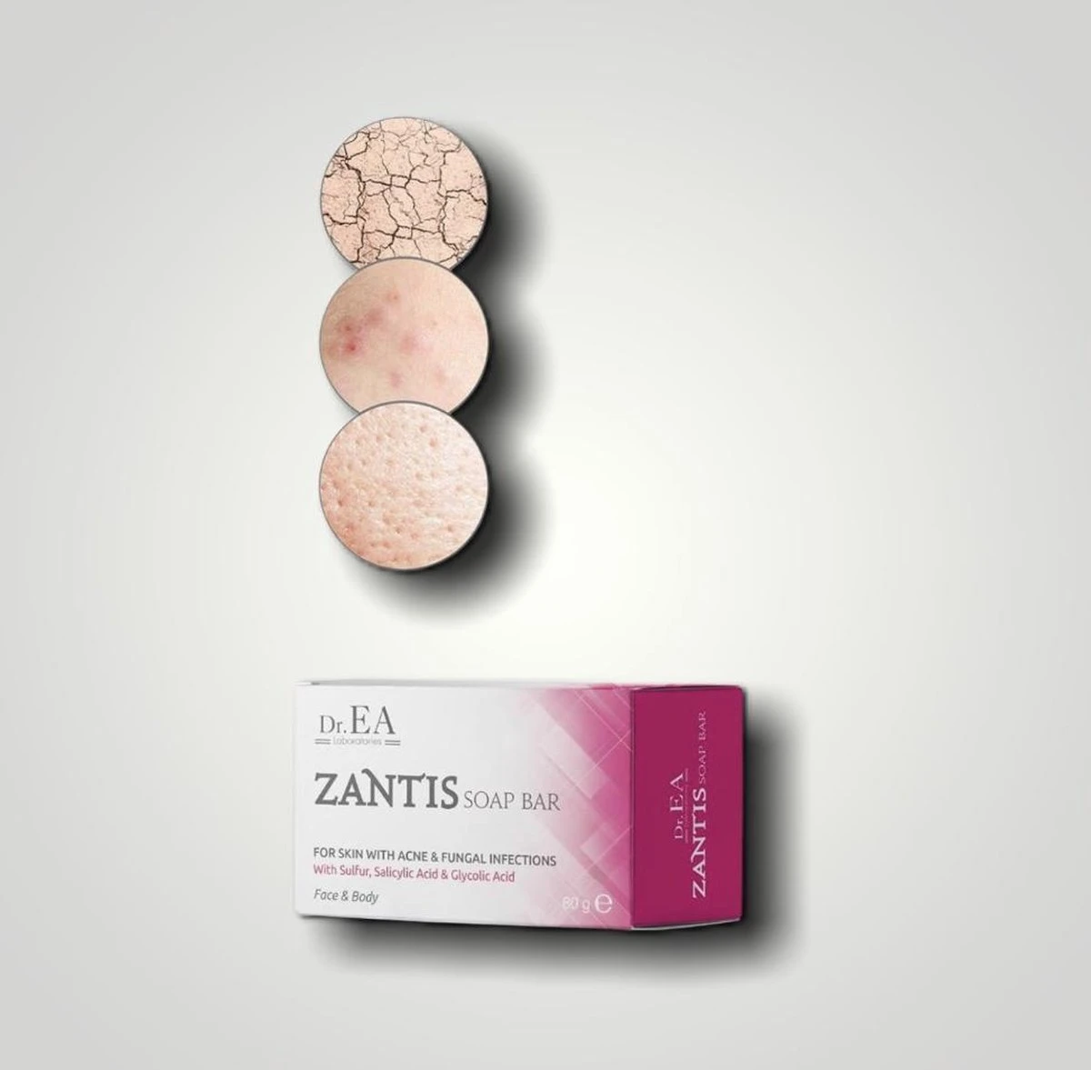 Dr EA Laboratories | Zantis | Medische Zeep Voor Gezicht En Lichaam | Voor Acne En Schimmelinfecties | Handzeep | Zwavel | Salicylzuur | Glycolzuur | Geel | Blok | 80 GR 6 Dr EA Laboratories | Zantis | Medische Zeep Voor Gezicht En Lichaam | Voor Acne En Schimmelinfecties | Handzeep | Zwavel | Salicylzuur | Glycolzuur | Geel | Blok | 80 GR - Afbeelding 6