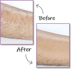 EPC® Duo Crystal Hair Removal Pad - Ontharings Pad - Pijnloos Ontharen - Kristal Haarverwijderaar - Scrubi - Ontharing Eraser Kristalpad - Bleame - Armen Benen Bikinilijn - Roze 7 EPC® Duo Crystal Hair Removal Pad - Ontharings Pad - Pijnloos Ontharen - Kristal Haarverwijderaar - Scrubi - Ontharing Eraser Kristalpad - Bleame - Armen Benen Bikinilijn - Roze -Verzorgingsvoordeel Huis 1200x1177 5