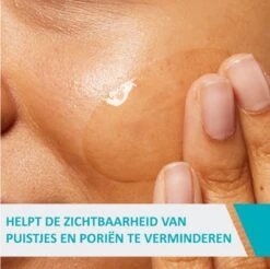 CeraVe Acne Control Gel - 40ml - Voor Onzuivere Huid Met Neiging Tot Acne -Verzorgingsvoordeel Huis 1200x1197