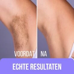 Premium Wax Set Inclusief 400gr Wax Bonen - Pre- & After-Wax Spray - 20 Aanbreng Spatels -Verzorgingsvoordeel Huis 1200x1200 1236