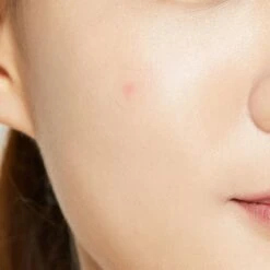 COSRX Acne Pimple Master 26 COSRX Acne Pimple Master -Verzorgingsvoordeel Huis 1200x1200 1463