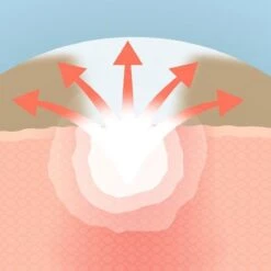 COSRX Acne Pimple Master 33 COSRX Acne Pimple Master -Verzorgingsvoordeel Huis 1200x1200 1466