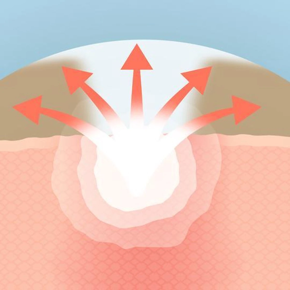 COSRX Acne Pimple Master 16 COSRX Acne Pimple Master - Afbeelding 16