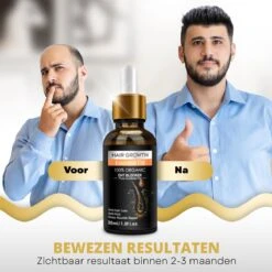 BeautyFit - Haargroei Serum - Haargroei Versneller - Inclusief Scalp Massager En Ebook - Haargroei Producten Mannen Vrouwen - Biotine - Haar Versneller - Beschadigd Haar - Haar Vitamines -Verzorgingsvoordeel Huis 1200x1200 1573