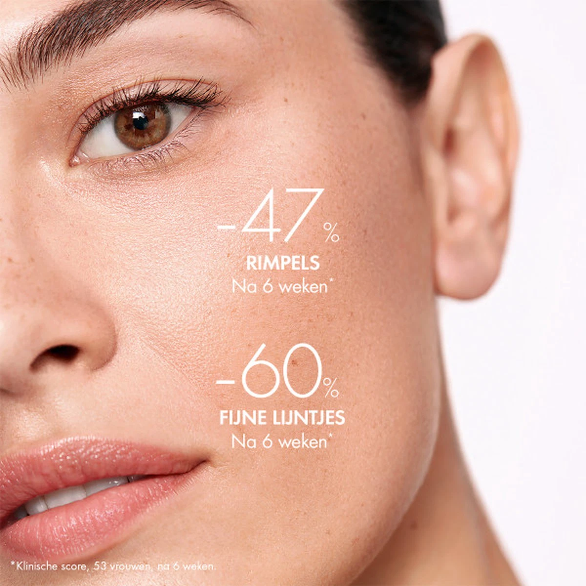 Vichy Liftactiv Supreme H.A. Epidermic Filler Serum - 30ml - Tegen Rimpels En Fijne Lijntjes, Ook Voor Gevoelige Huid 5 Vichy Liftactiv Supreme H.A. Epidermic Filler Serum - 30ml - Tegen Rimpels En Fijne Lijntjes, Ook Voor Gevoelige Huid - Afbeelding 5