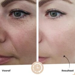 Vitamine C Serum Van Vicius® - Gezichtsverzorging Met Hyaluronzuur - Acne - Serum Gezicht - Anti Aging - 30ML -Verzorgingsvoordeel Huis 1200x1200 1596