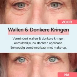 Remescar Wallen En Donkere Kringen 8ml - Crème Voor Wallen - Donkere Kringen Verwijderaar - Verwijdert Wallen Onder De Ogen - Onmiddellijke Wallen Behandeling - 180 Applicaties -Verzorgingsvoordeel Huis 1200x1200 1708