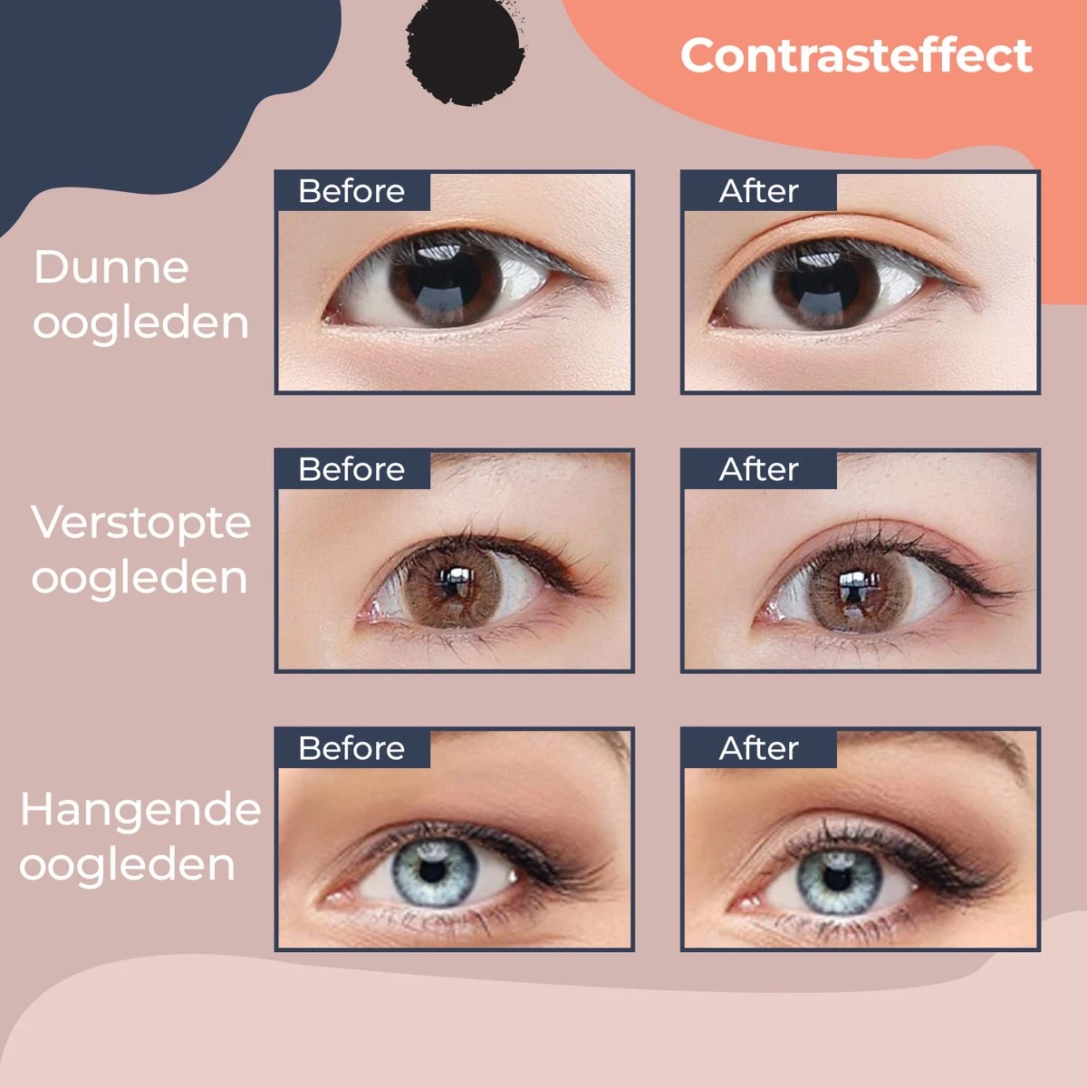 Le Civa Ooglidstickers Onzichtbaar 460 Stuks – Ooglidtape – Ooglidcorrectie – Ooglift Strips – Ooglid – Eye Tape – Hangende Oogleden – Vermoeide Ogen 5 Le Civa Ooglidstickers Onzichtbaar 460 Stuks – Ooglidtape – Ooglidcorrectie – Ooglift Strips – Ooglid – Eye Tape – Hangende Oogleden – Vermoeide Ogen - Afbeelding 5