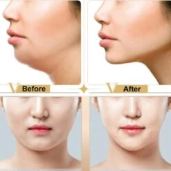 Facelift Masker - Gezicht Afslank Masker V-Line 7 Facelift Masker - Gezicht Afslank Masker V-Line -Verzorgingsvoordeel Huis 1200x1200 1902