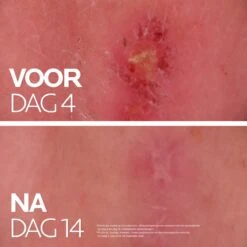 La Roche-Posay Cicaplast Balsem B5+ - 100ml - Voor Gevoelige Huid -Verzorgingsvoordeel Huis 1200x1200 25