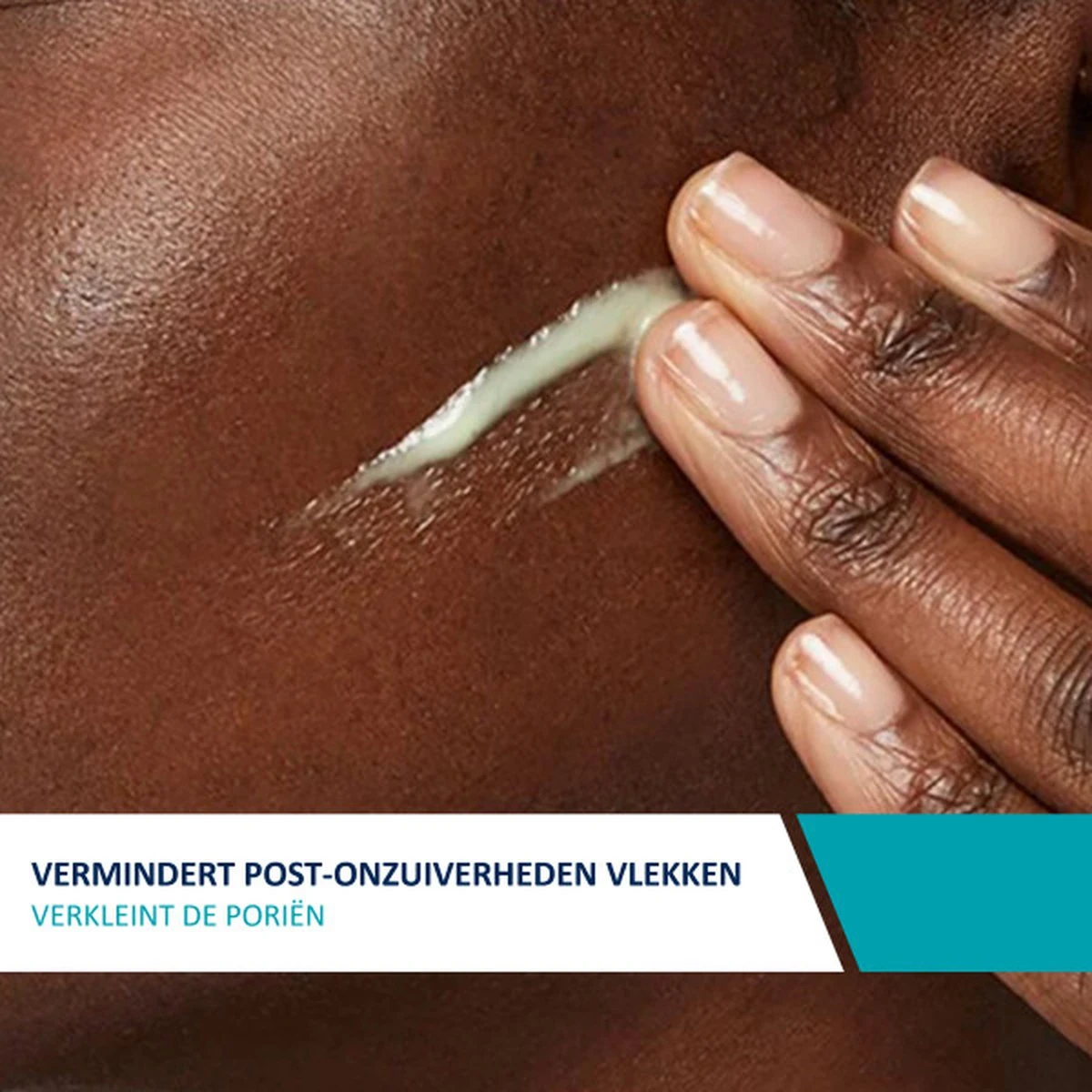 CeraVe Resurfacing Retinol Serum - 30ml - Voor Onzuivere Huid Met Neiging Tot Acne 7 CeraVe Resurfacing Retinol Serum - 30ml - Voor Onzuivere Huid Met Neiging Tot Acne - Afbeelding 7