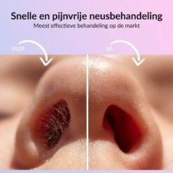 Rivema Luxe Wax Ontharing Set – Neus Ontharing – Wax Beans – Ontharingswax – Ontharen – 7 Maanden Haarvrij -Verzorgingsvoordeel Huis 1200x1200 894