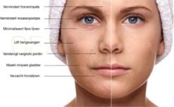 Titanium - 540 Micro-Needle 0.5mm DermaRoller | Skin Roller | Gezichts- En Huidverzorging | Huidverjonging | Steriel Verpakt | Gold Edition -Verzorgingsvoordeel Huis 1200x739