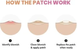 Merkloos Pimple Patch - Acne Patch - Puisten Patch - Acne Sticker - Puisten Pleister - Pimple Patches - Acne Pleister - Puisten Verwijderaar - Puisten Creme - Acne Verwijderen Set - Acneverzorging | 36 Stuks & Directe Levering -Verzorgingsvoordeel Huis 1200x769 1