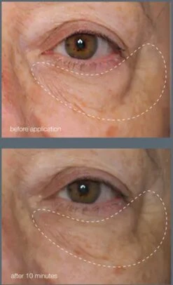 Dermalogica - Awaken Peptide Eye Gel - Revitaliserend - Hydraterend 11 Dermalogica - Awaken Peptide Eye Gel - Revitaliserend - Hydraterend -Verzorgingsvoordeel Huis 730x1200 7