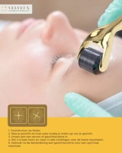 Dermaroller – 540 Micro Naalden – 0.5 MM Needle – Huidverjonging – Huidverzorging – Littekens – Striea – Steriel Verpakt 17 Dermaroller – 540 Micro Naalden – 0.5 MM Needle – Huidverjonging – Huidverzorging – Littekens – Striea – Steriel Verpakt -Verzorgingsvoordeel Huis 960x1200 61