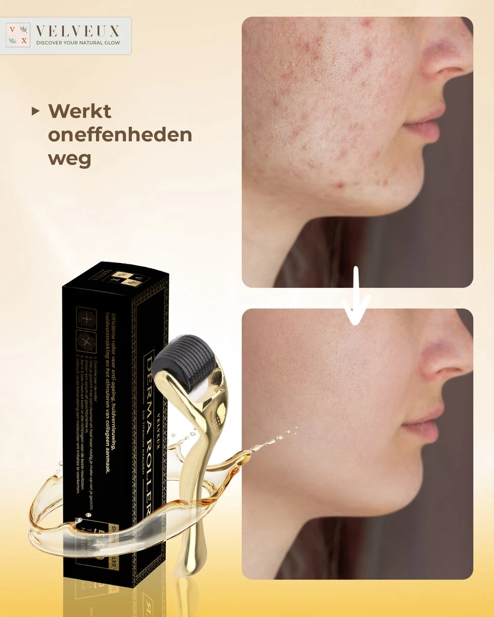 Dermaroller – 540 Micro Naalden – 0.5 MM Needle – Huidverjonging – Huidverzorging – Littekens – Striea – Steriel Verpakt 8 Dermaroller – 540 Micro Naalden – 0.5 MM Needle – Huidverjonging – Huidverzorging – Littekens – Striea – Steriel Verpakt - Afbeelding 8